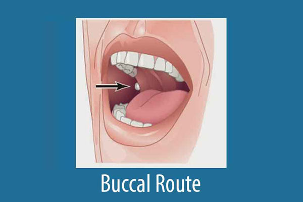 Buccal Medicine