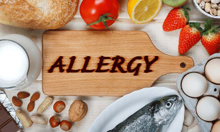 Allergies and dietary needs