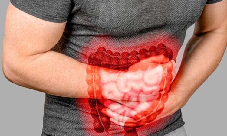 Bowel disease