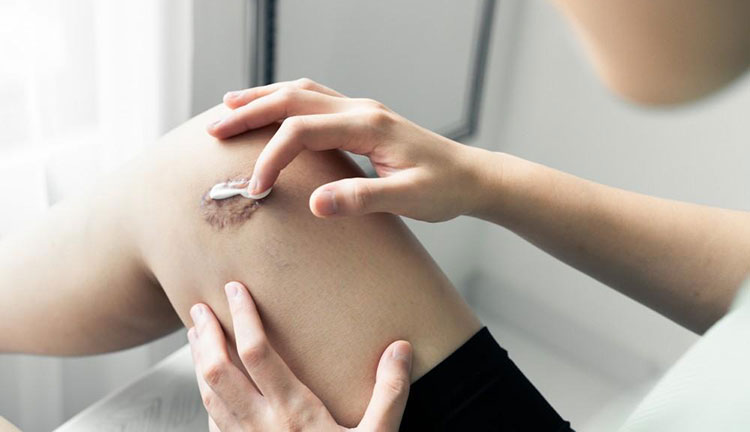 Ease of applying and removing