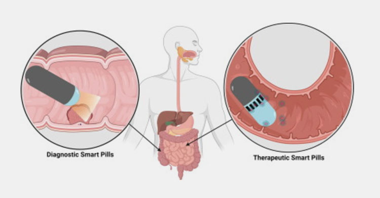 In the small intestine
