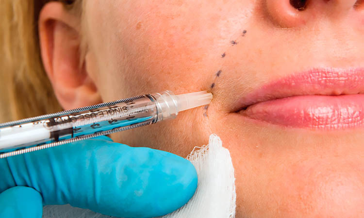 Dermal fillers