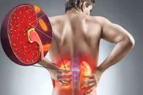 Kidney stress effect