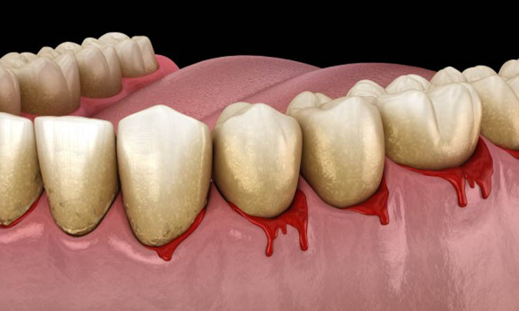 Periodontics