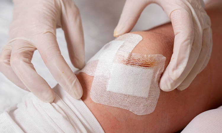 Wound dressing