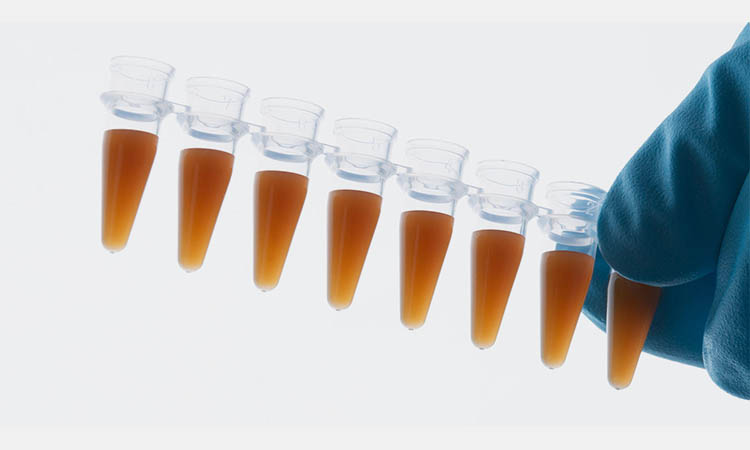 Extraction and purification